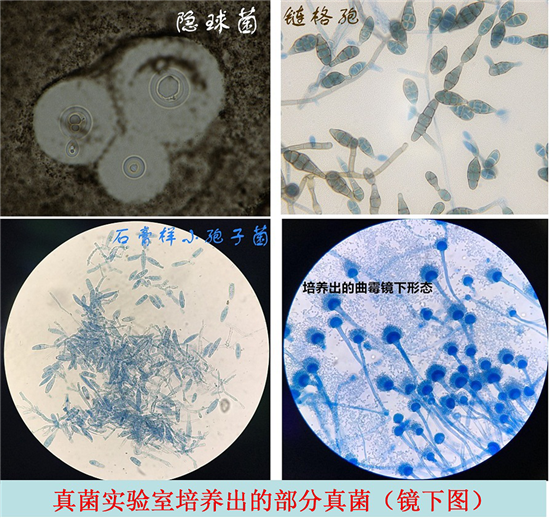 潍坊市中医院检验科真菌实验室成立