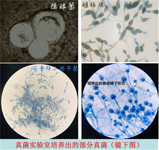 真菌感染有不断上升的趋势,真菌已成为医院感染的常见病原菌之一,能否