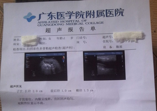 胃癌图片报告单图片