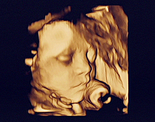 怀双胎的检查b超图片图片